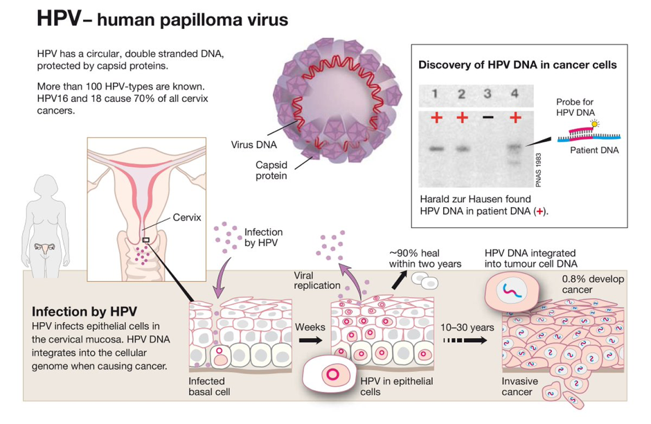 Illustration describing HPV