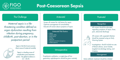 sepsis